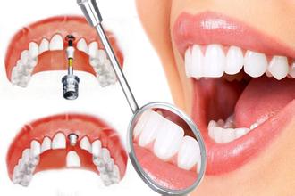 种植牙术后需要做好哪些护理